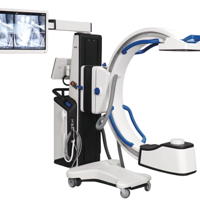 Мобильный рентгенохирургический аппарат ВКО Медпром Р-600 «Опервиз»